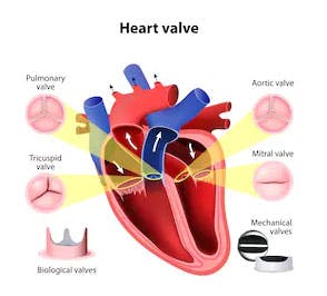 heart valve